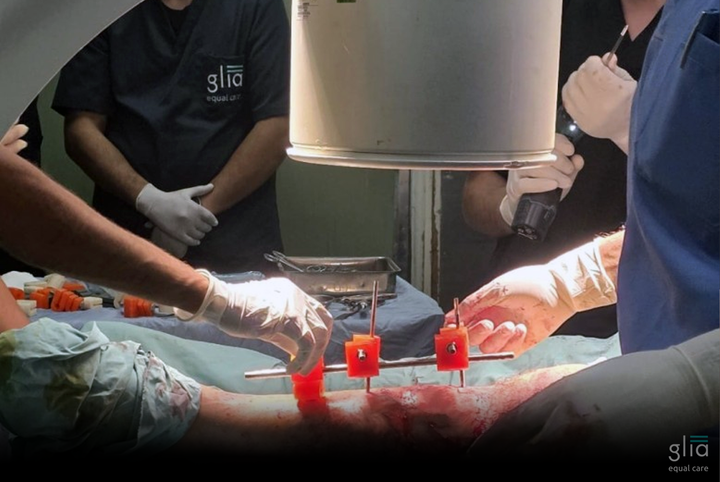 Palestinian-Led Team Produces First Fully Local External Fixator in Gaza Using Recycled Plastics, 3D Printing, and Solar Power