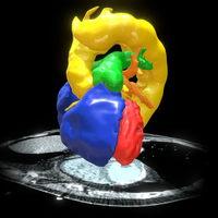 Normal Heart Blood Pool Model